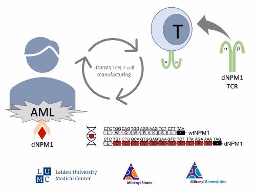Immunotherapy targeting mutant nucleophosmin-1 on acute myeloid leukemia