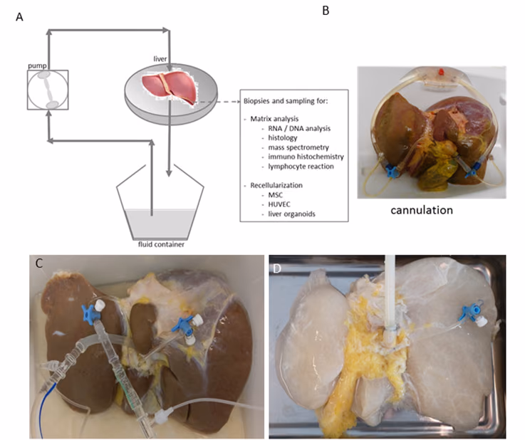 Bio-engineering functional liver tissue from human biomatrix and liver stem cells: The Matrix Reloaded