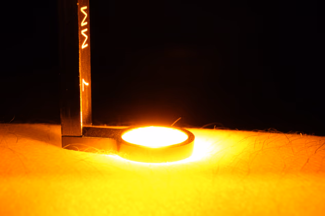 Maximizing treatment free duration of remission in psoriasis through selective photothermolysis