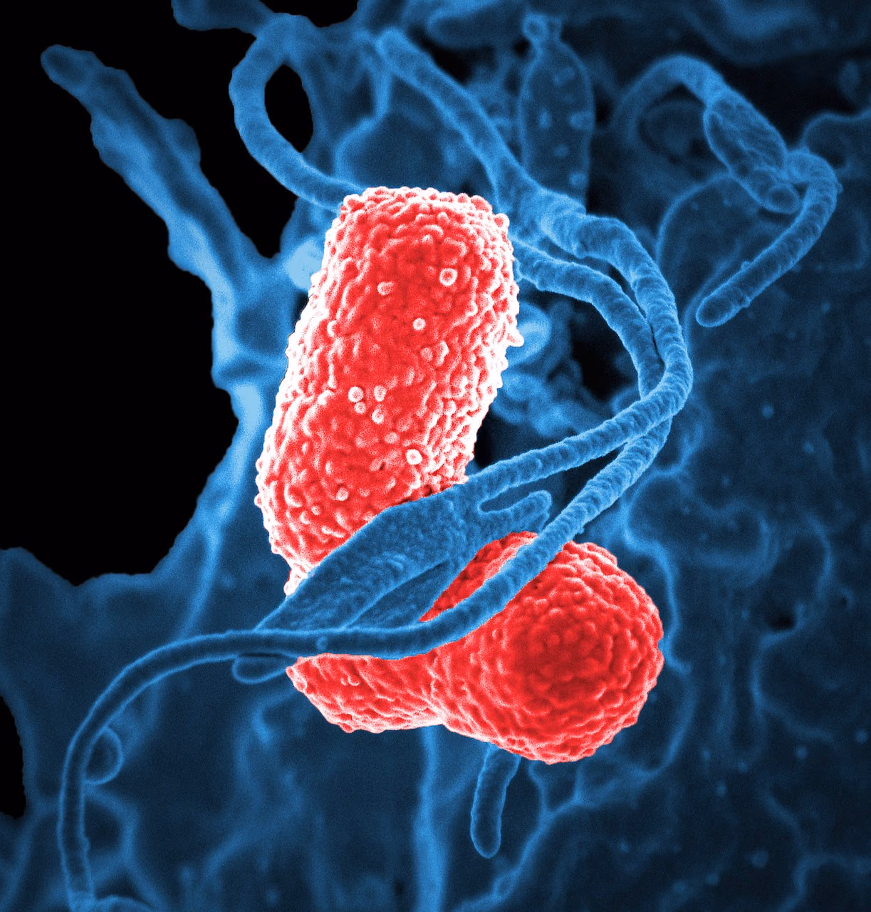 REConstituting the microbiome After Pneumonia - RECAP