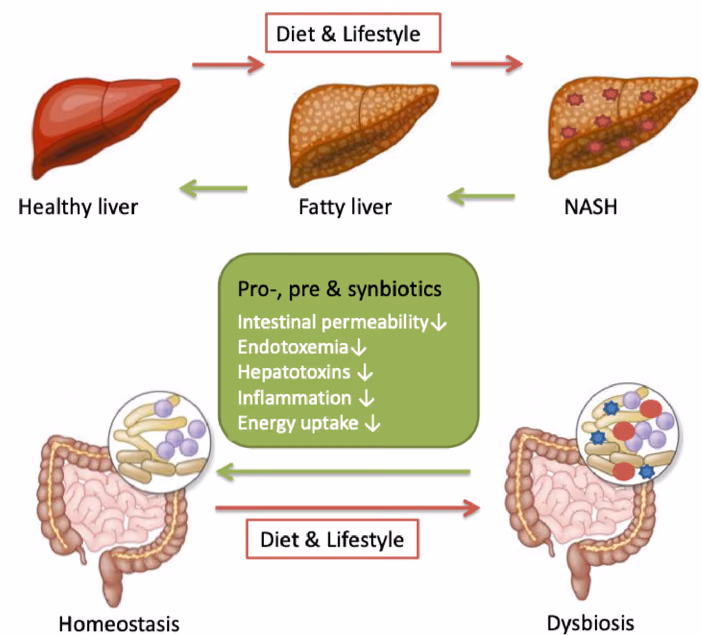 The BARNARD-study: Butyrate-producing intestinal bActeria to pReveNt progression from non-alcoholic fAtty liveR Disease to non-alcoholic steatohepatitis