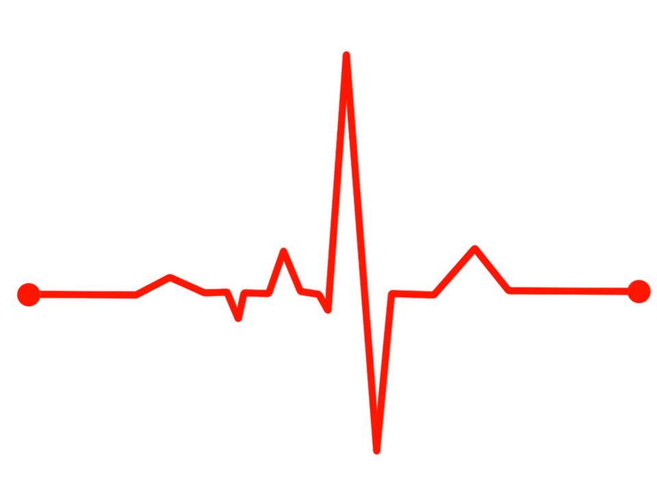 LentiPace II validates and implements functional studies for creating biological pacemakers with long-term function using lentiviral-based gene therapy