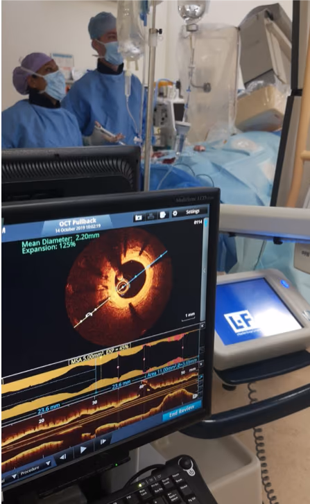 Identification of patients at risk for recurrent cardiovascular events after myocardial infarction using optical coherence tomography – the PECTUS-obs study