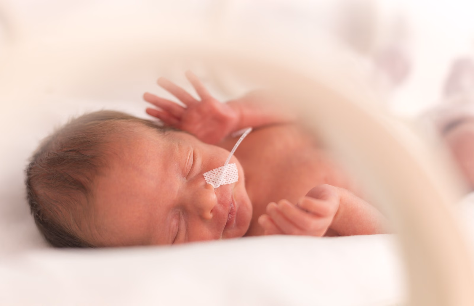 Human milk sugars for the prevention of brain injury in extreme preterm infants