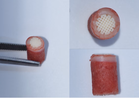 Gradient scaffolds for the treatment of osteochondral defects in the knee – evaluation in an ex vivo osteochondral platform with follow-up by ultra-high field MRI