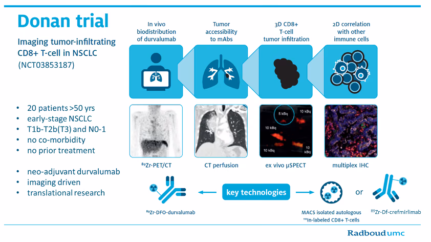 Imaging Tumor-Infiltrating T-cells in Non-Small Cell Lung Cancer (Donan trial)