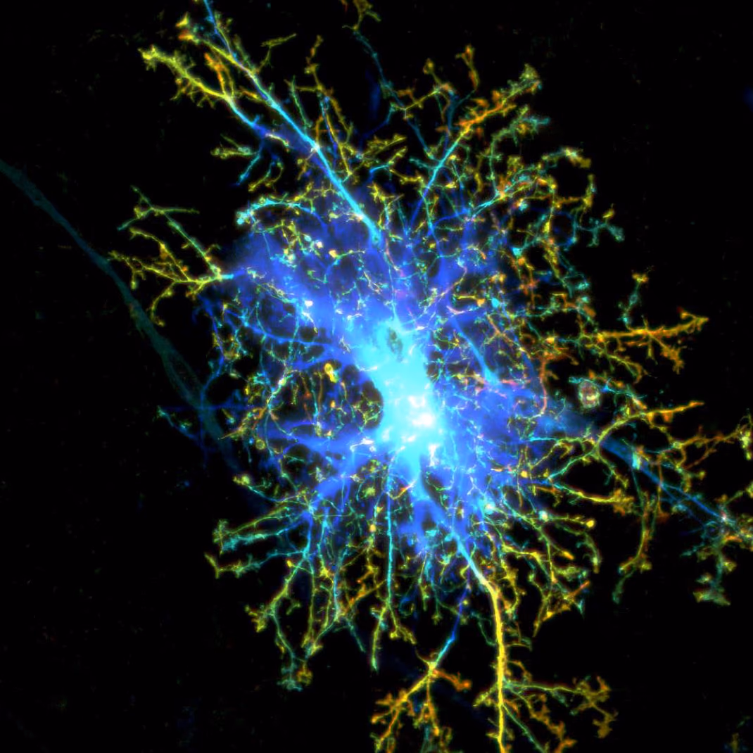 Modelling tau pathology in human neuron/astrocyte co-cultures