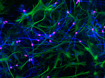 Measuring electrical activity of cultured human neurons