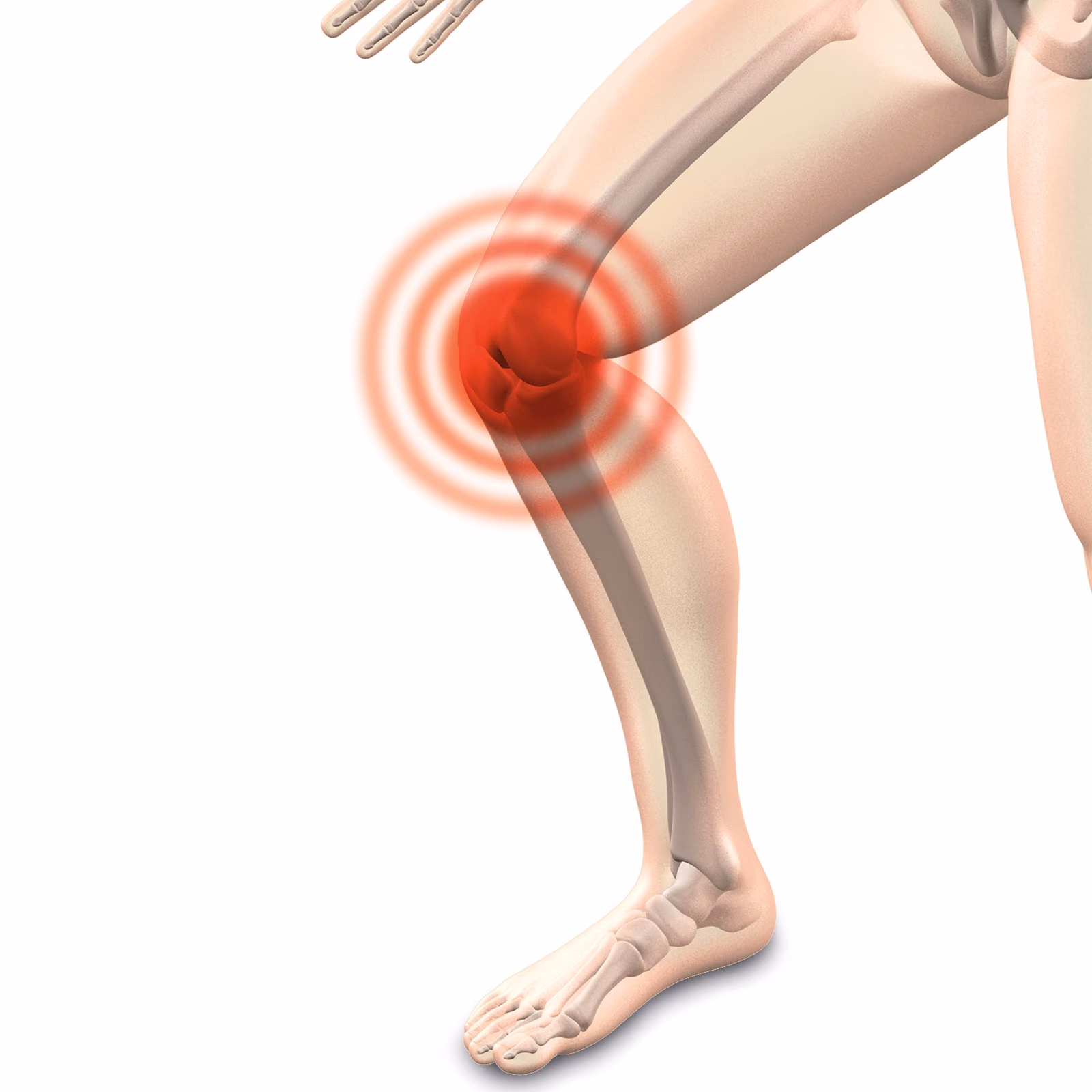 Functional joint Repair that Enables Enjoyment of Durable and Organic Mobility (FREEDOM)