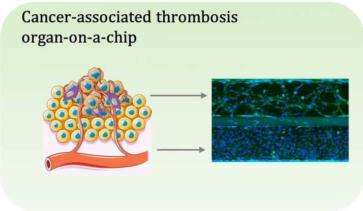 Developing animal-free methods to study thrombosis in cancer patients.