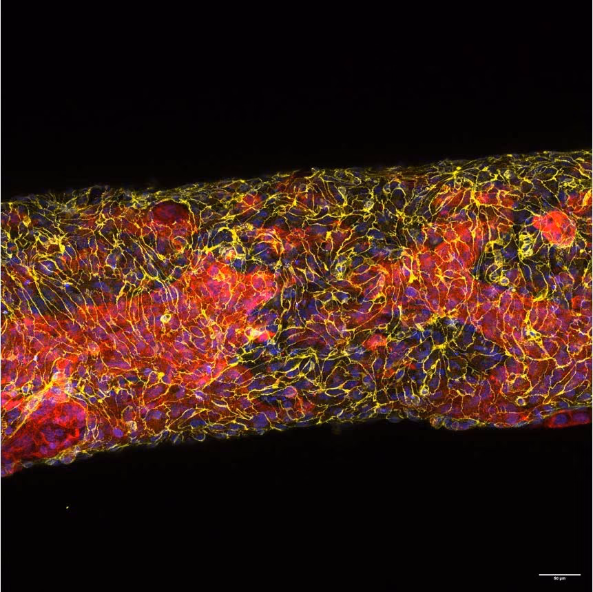Functional lipoprotein lipase expression and modulation using heart-on-chip technology: towards a novel screening system for lipid-lowering therapy.