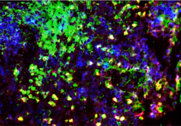 Neutrophils as clinical targets to prevent tissue damage in chronic inflammation and autoimmunity