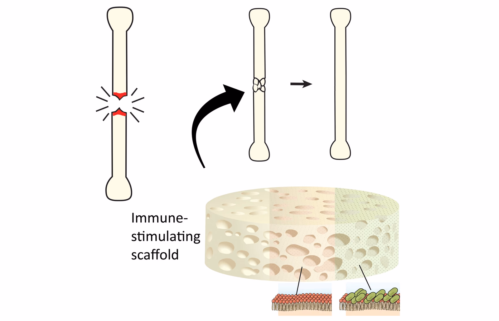 iBone: Inflammation-controlled stimulation of bone formation