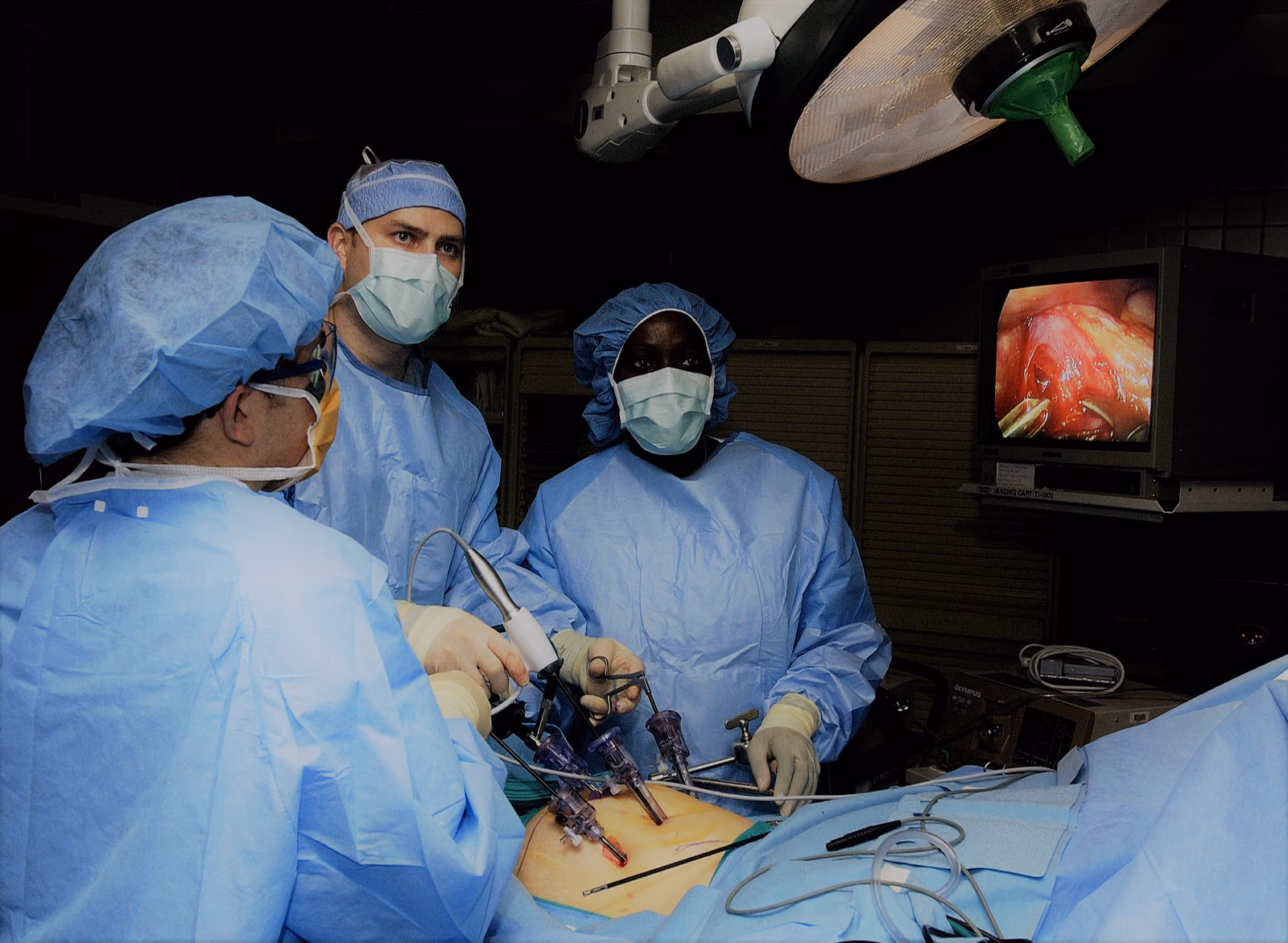 CT measurements of the effects on surgical working space of regular versus deep neuromuscular blockade: studies in a porcine laparoscopy model