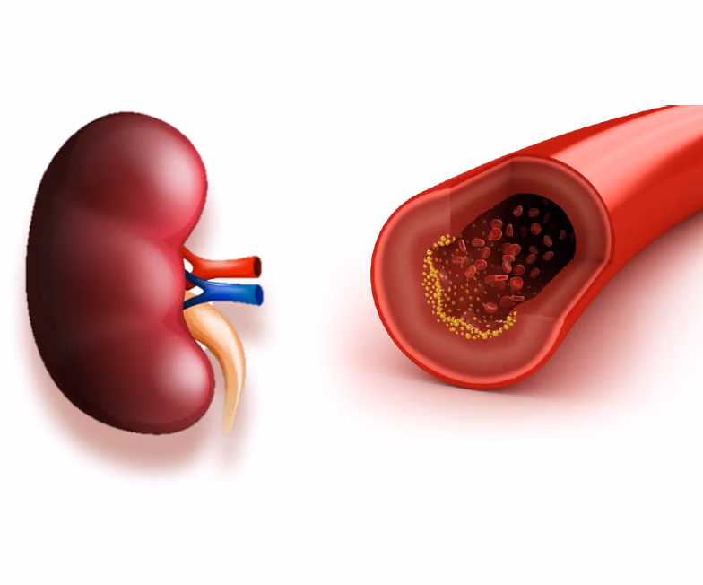 Protection from Cardiovascular Disease by Magnesium