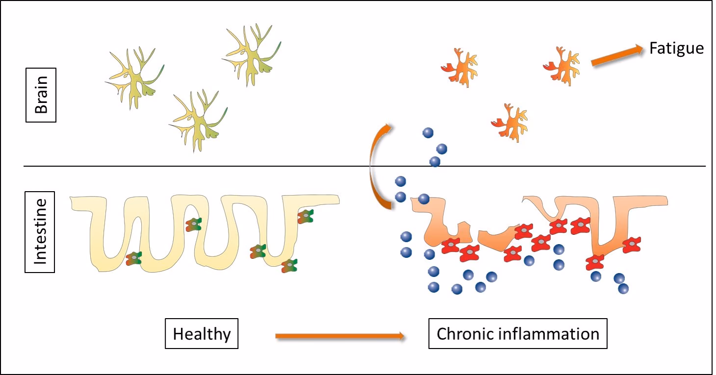 Macrophages as a target for the treatment of fatigue in chronic inflammatory disorders