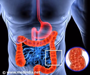 The effects of specific kinase inhibitors in colitis models.