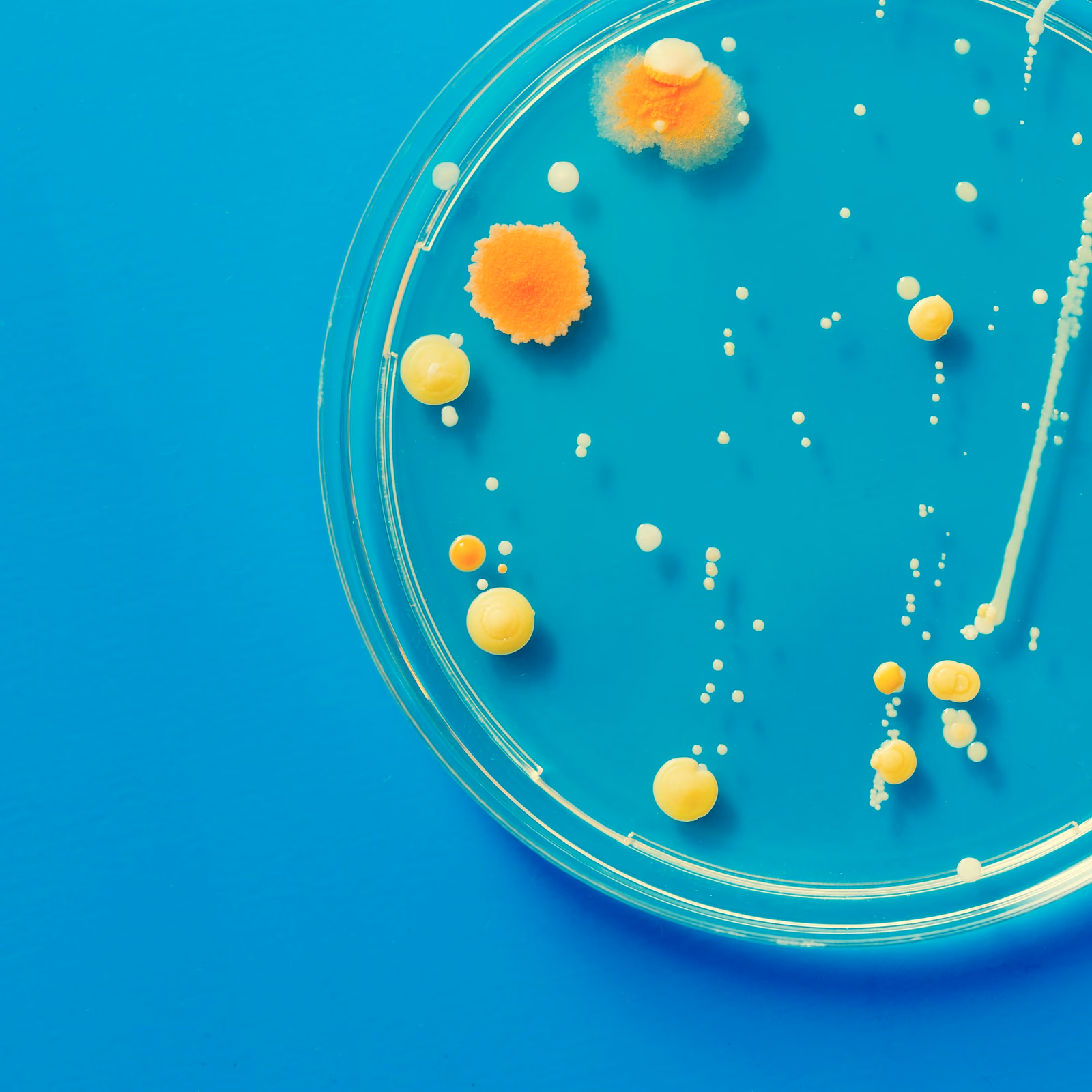 PharmAMPs: Pharmaceutical development of antimicrobial peptides for the prevention and treatment of infections against (multi)-drug resistant bacteria.