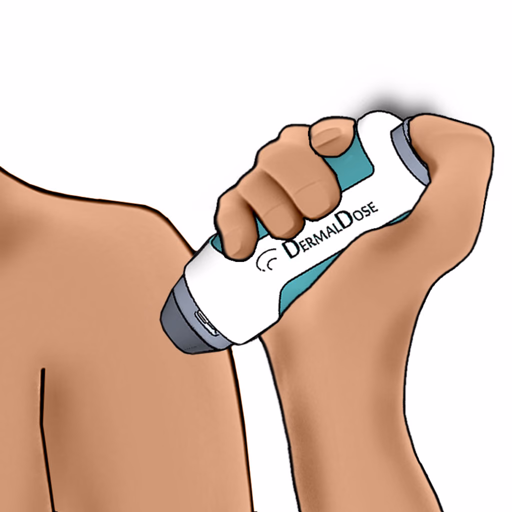 Development of a microneedle-based intradermal vaccine delivery device.
