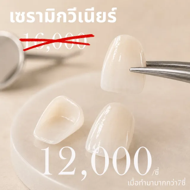 แผ่นเซรามิกวีเนียร์บางคีบด้วยปากคีบ วางเทียบกับชิ้นอื่นบนจานเซรามิก