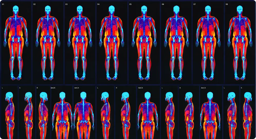 Grid of colourful full-body thermal scans showing heat distribution across human bodies