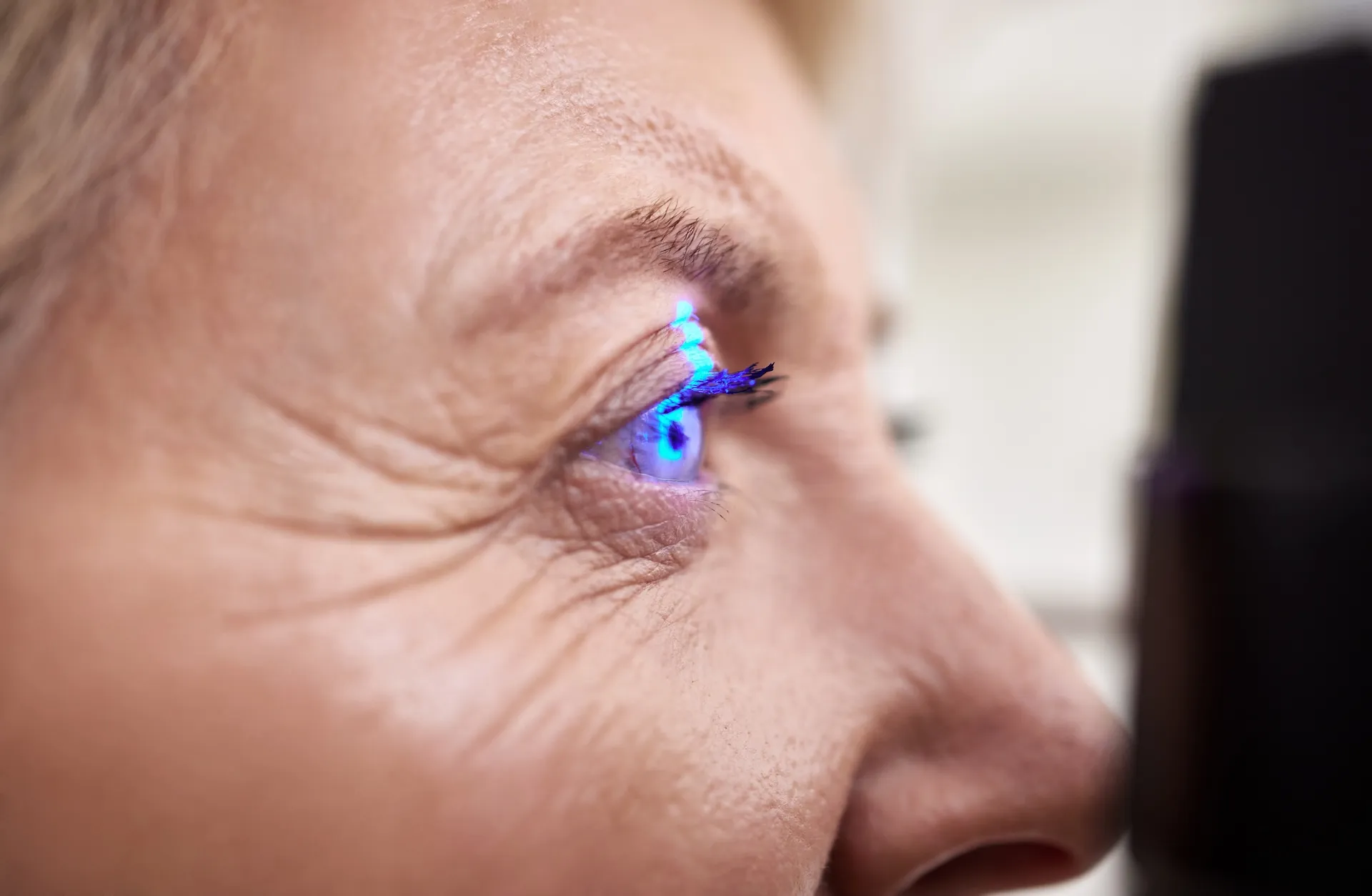 Laser Retinopexy