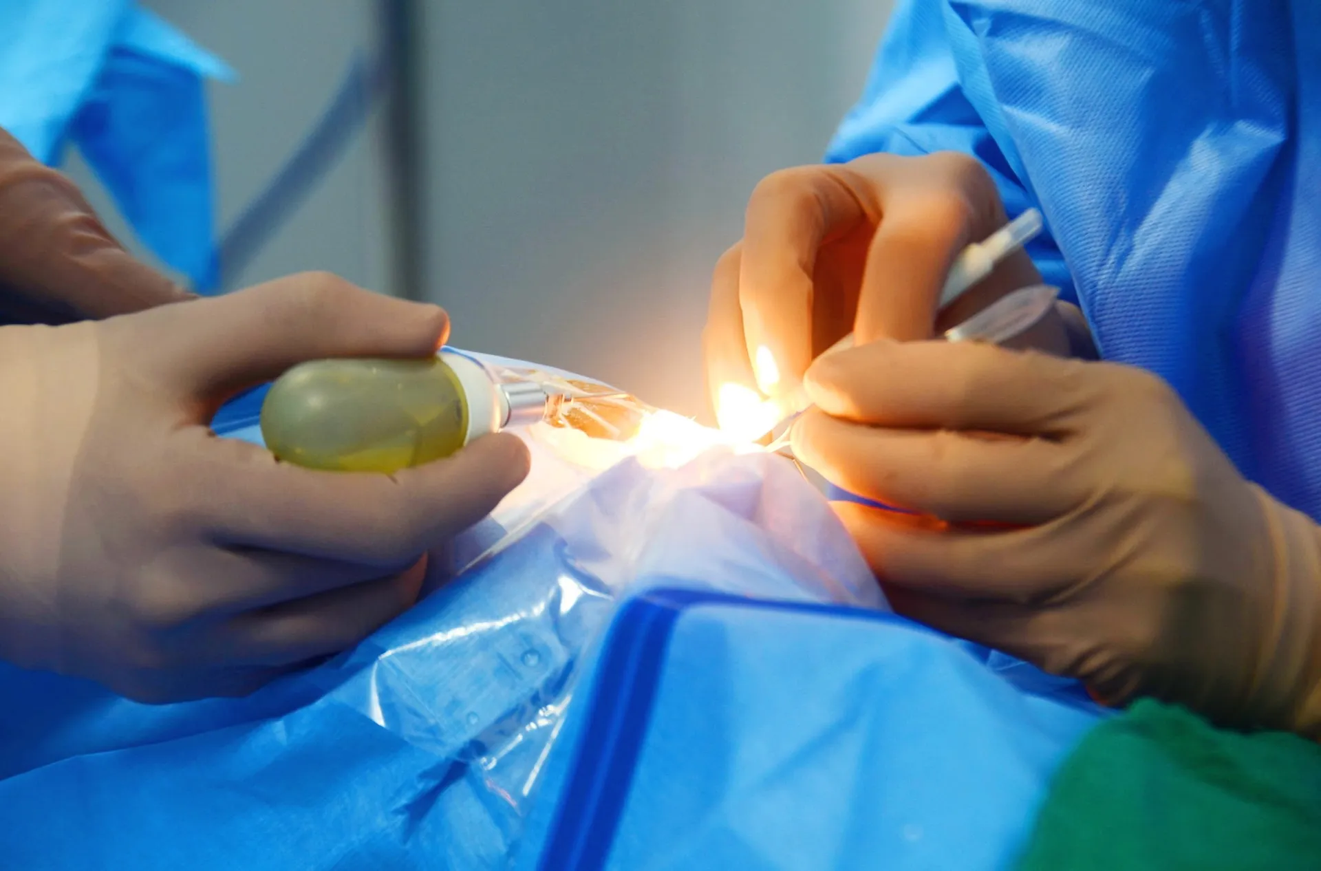Cornea Transplant