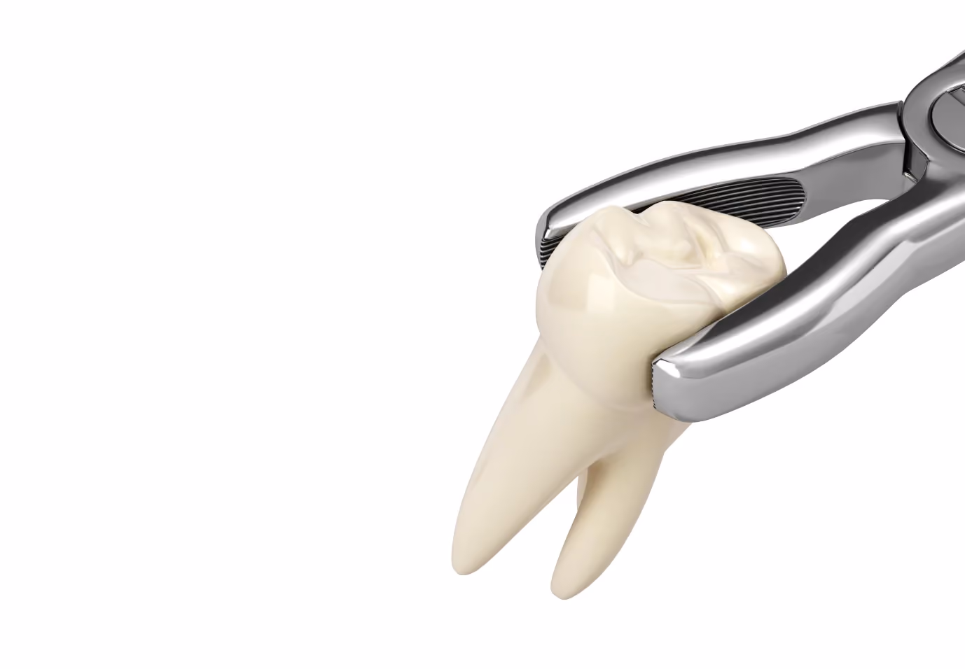Tooth Extractions in Long Beach, CA