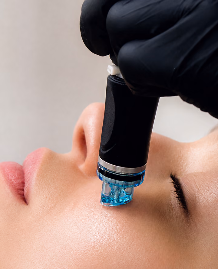 Behandlerin appliziert das HydraFacial-Gerät mit Saphirspitze an der Nase der Kundin