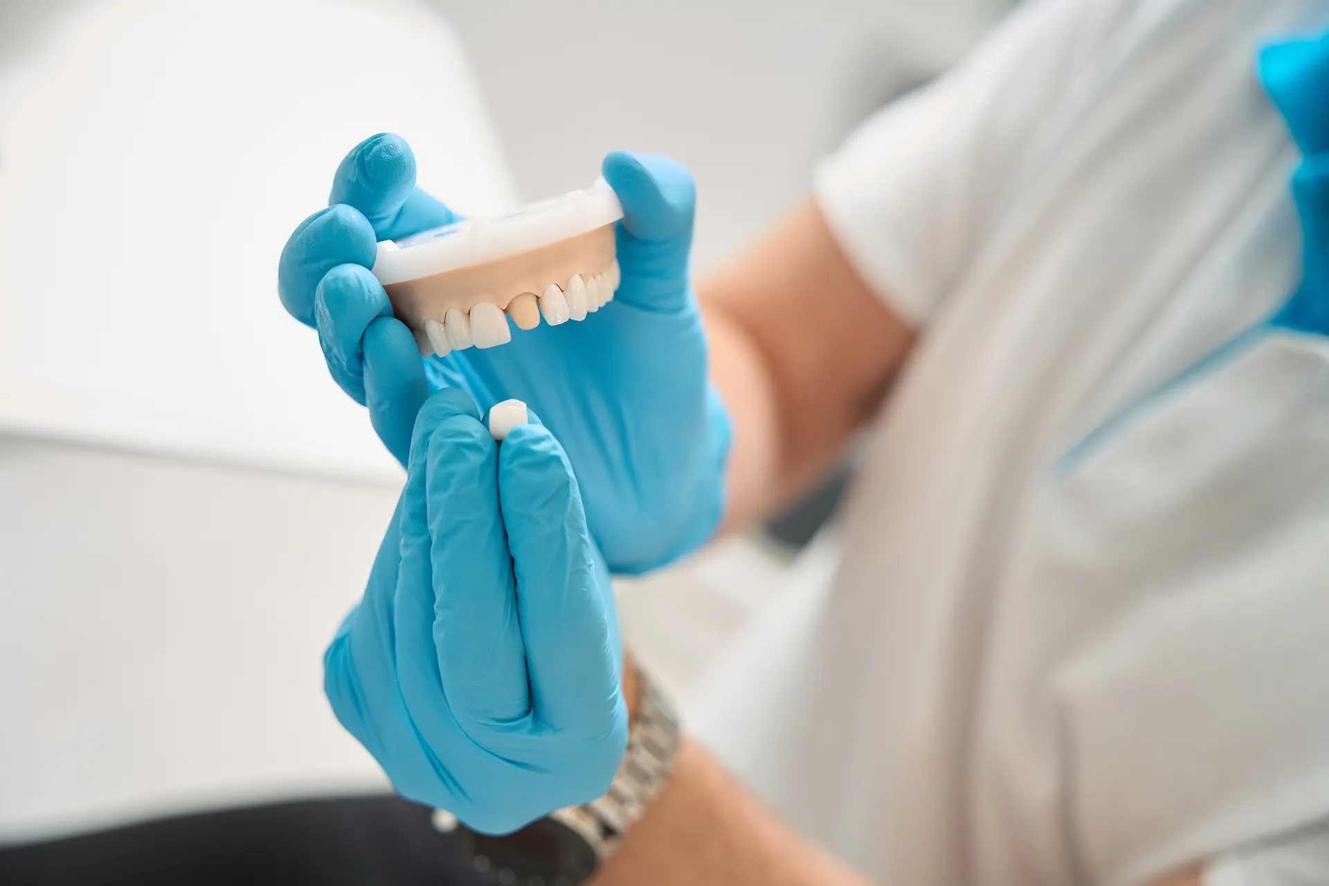 Person wearing blue gloves holding a dental model and a single artificial tooth.