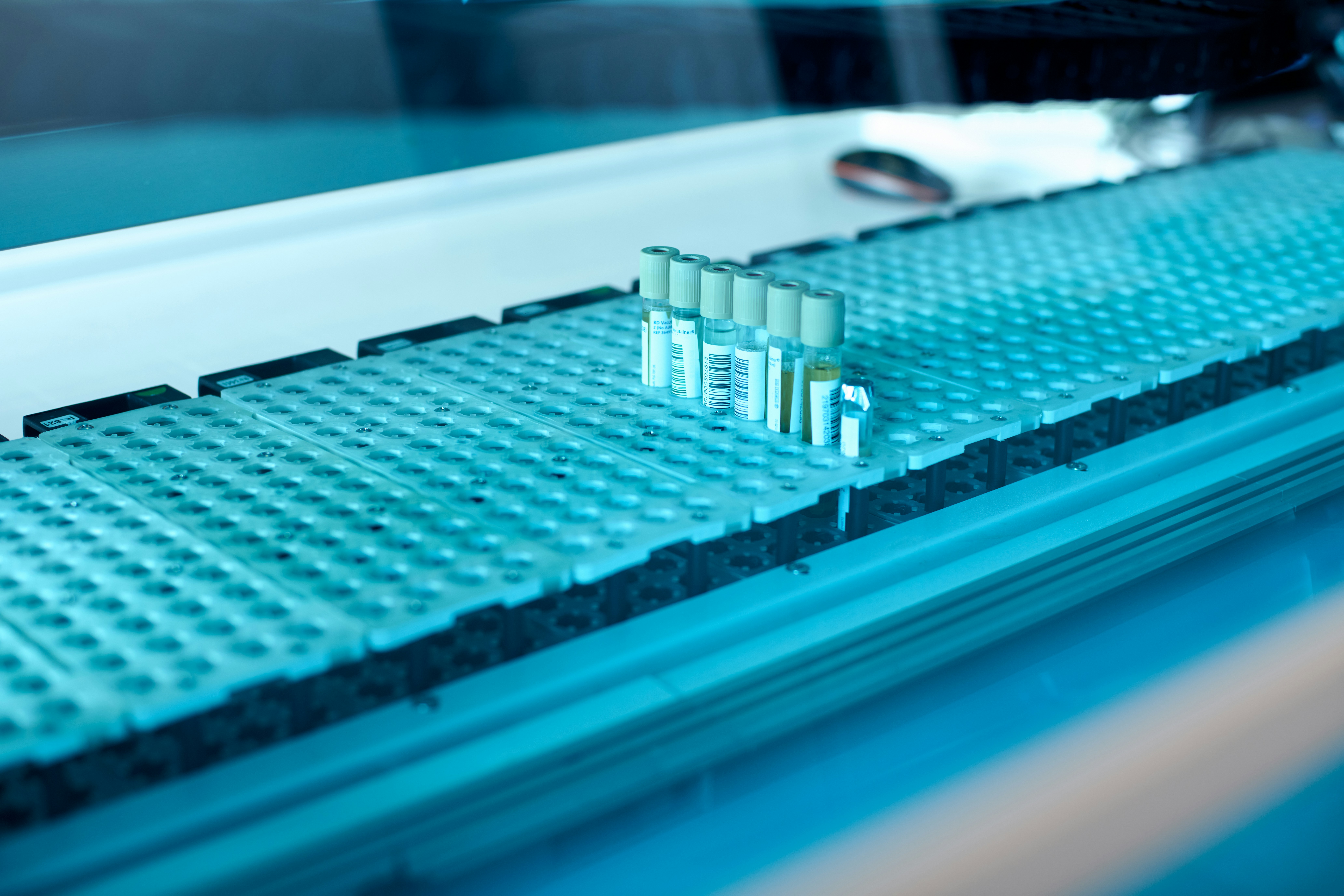 Échantillons biologiques en tubes à essai placés sur un plateau de laboratoires automatisé bleu pour analyse médicale.