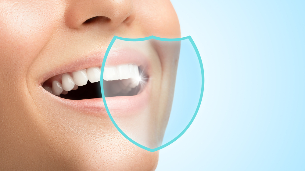 Summary of dental implant benefits