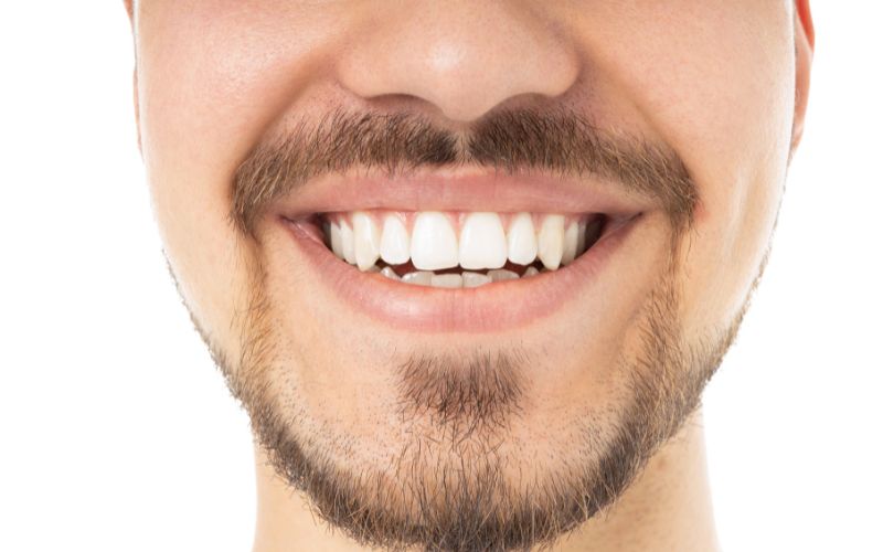 Professional Teeth Whitening vs. Over-the-Counter Kits: Which Option Delivers Better Results?