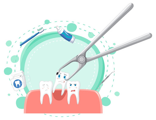 Tooth extraction recovery tips
