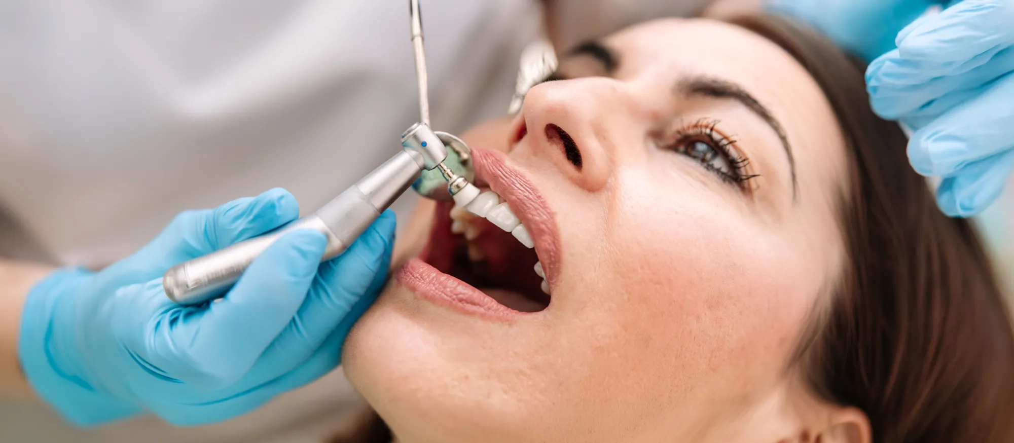 Dentist reshaping and polishing a patient's teeth