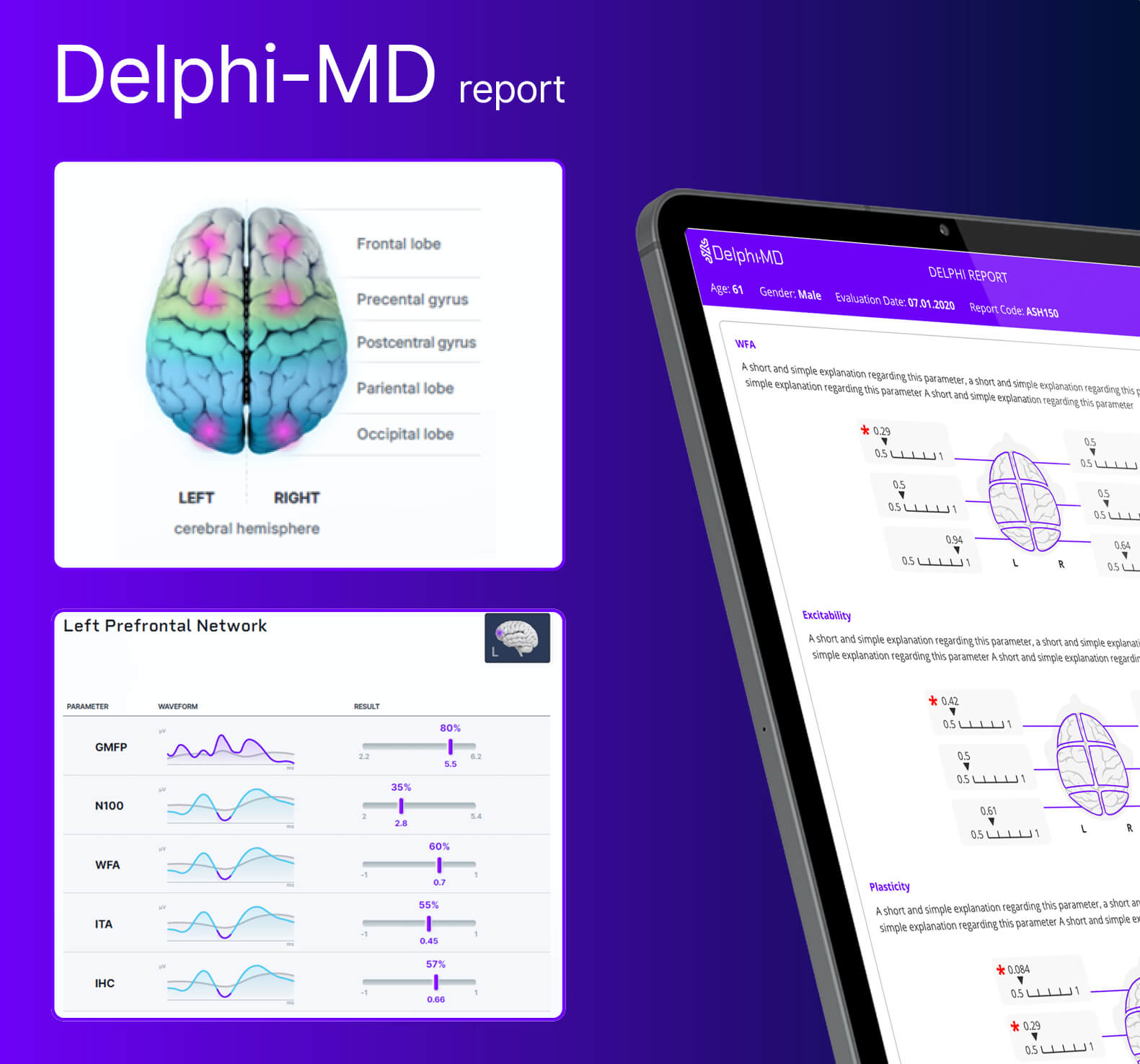 Delphi-MD report shown on a tablet and a phone