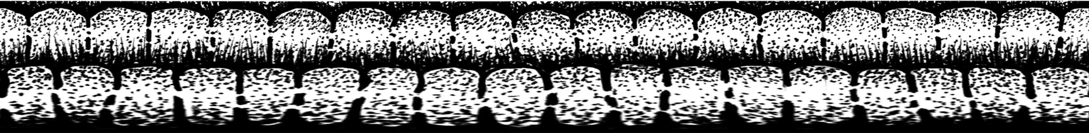 Interconnection inner border band variation.