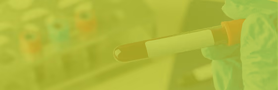 Holding a blood sample vial for hormone testing