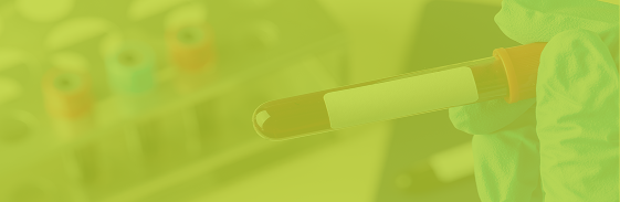Holding a blood sample vial for hormone testing