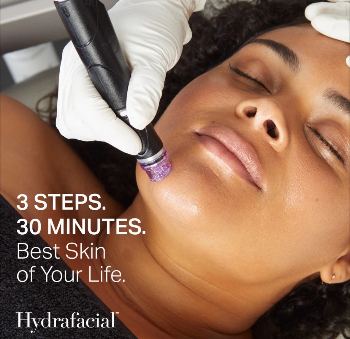 HydraFacial handpiece applied to the cheek. Promotional image text: “3 steps. 30 minutes. Best Skin of Your Life.”