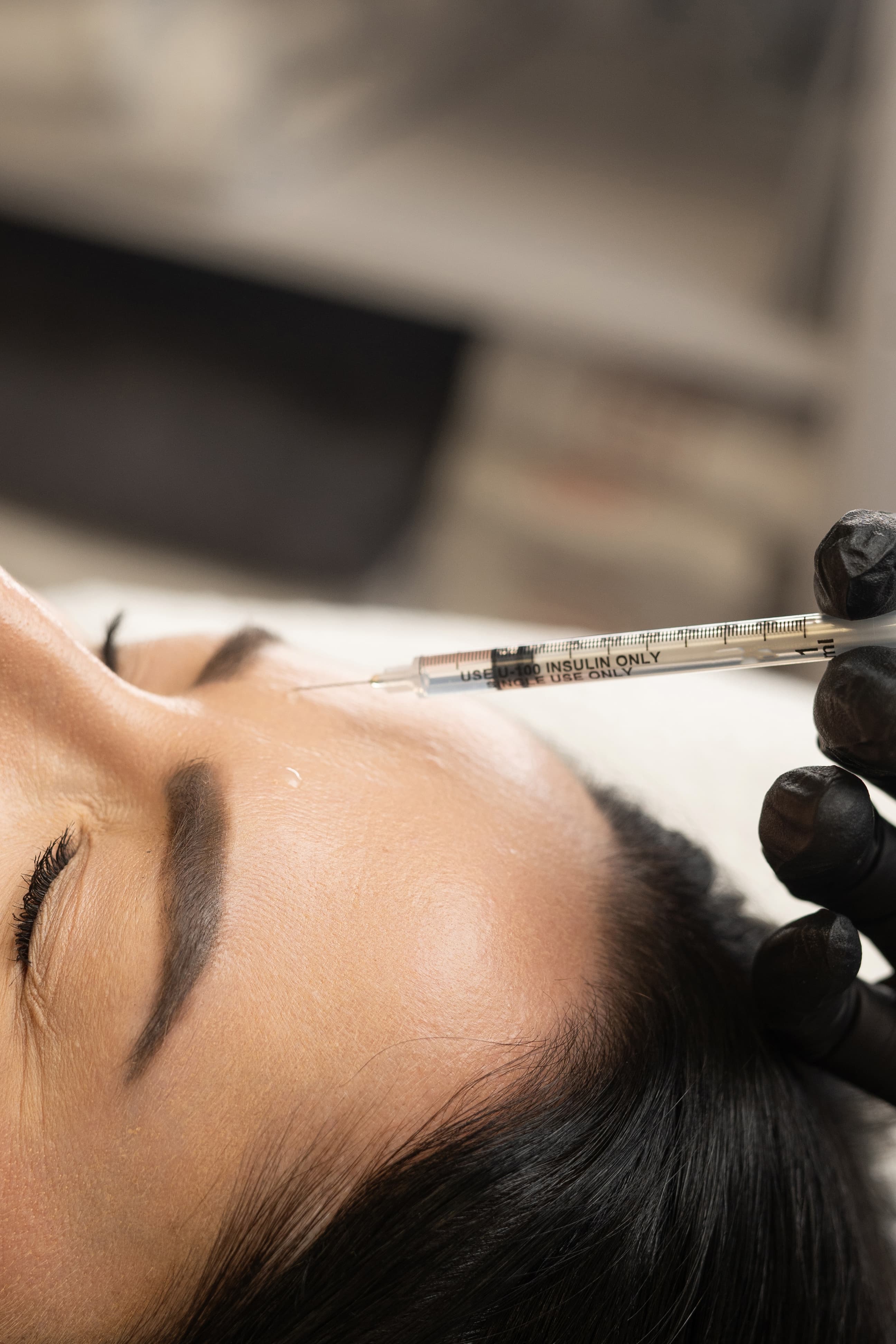 Close-up of a person receiving a cosmetic injection on the forehead with a syringe held by a hand wearing a black glove.