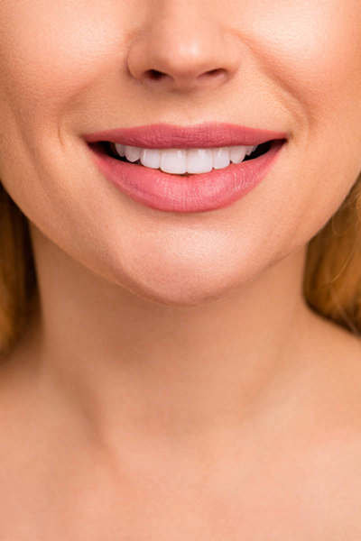 Lip Fillers