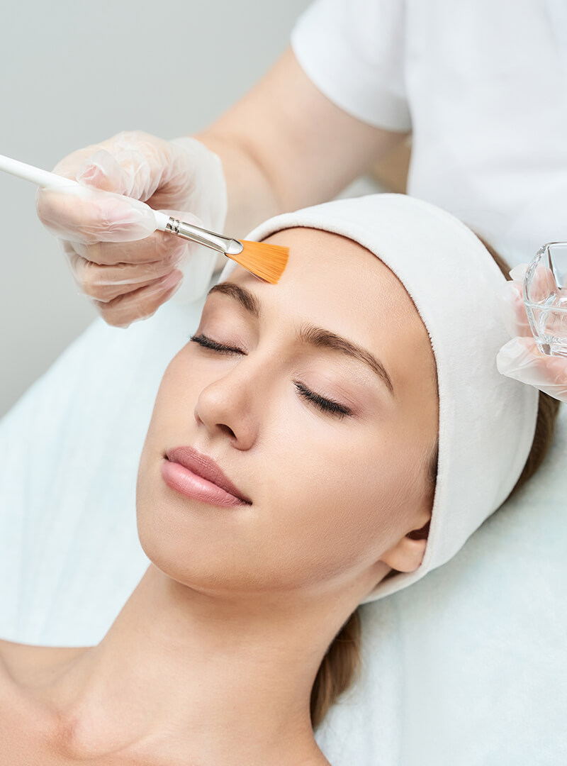 Chemical Peels