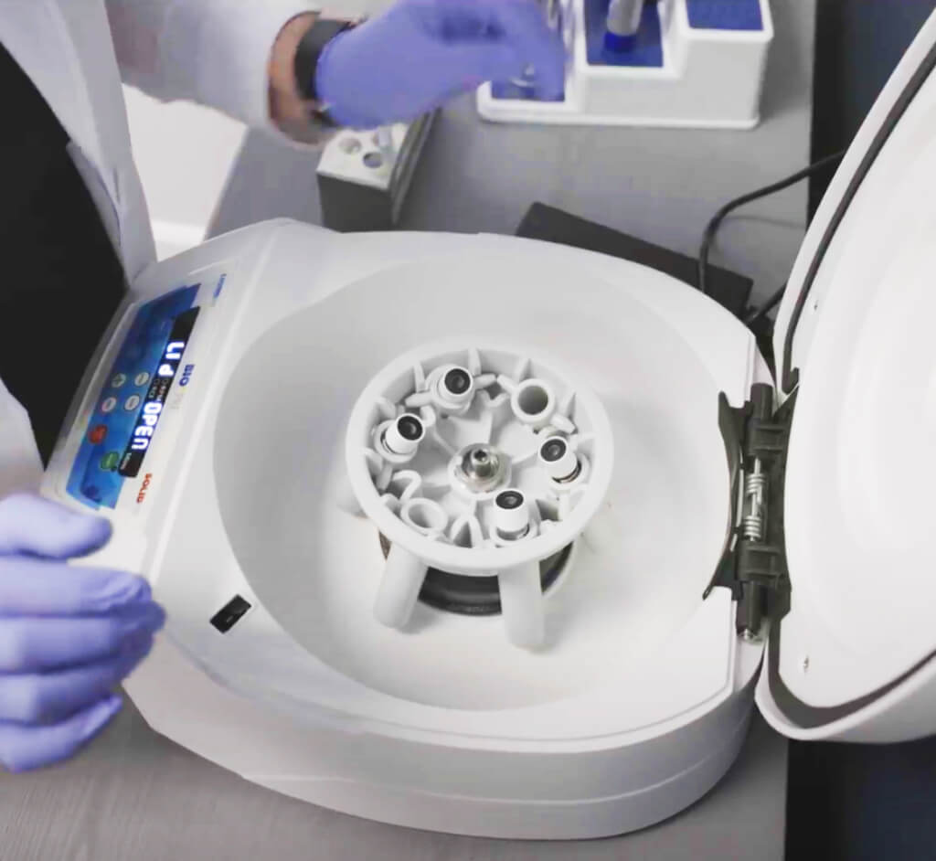 What is Platelet-Rich Fibrin therapy?
