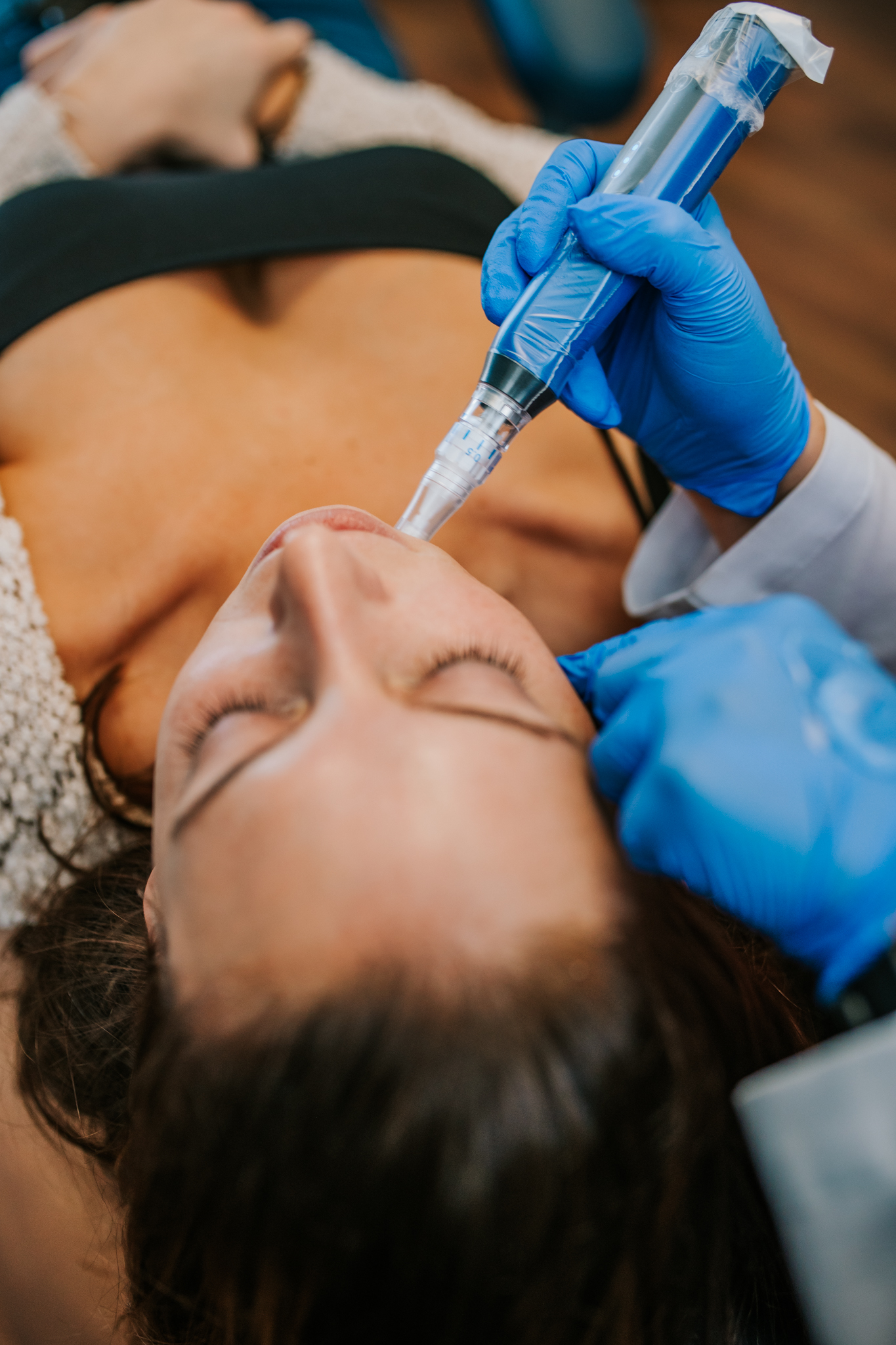 Benefits of Platelet-Rich Fibrin therapy