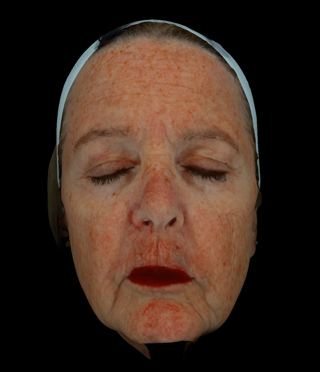 Red Blood diagnostic imaging view