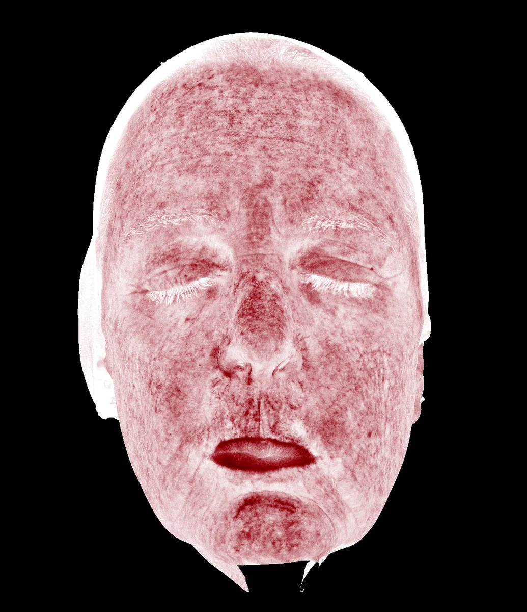 Deep Red Zone diagnostic imaging view