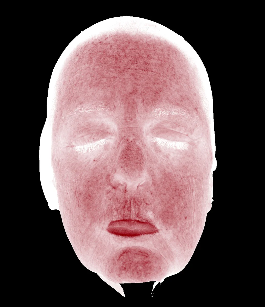 Shallow Red Zone diagnostic imaging view