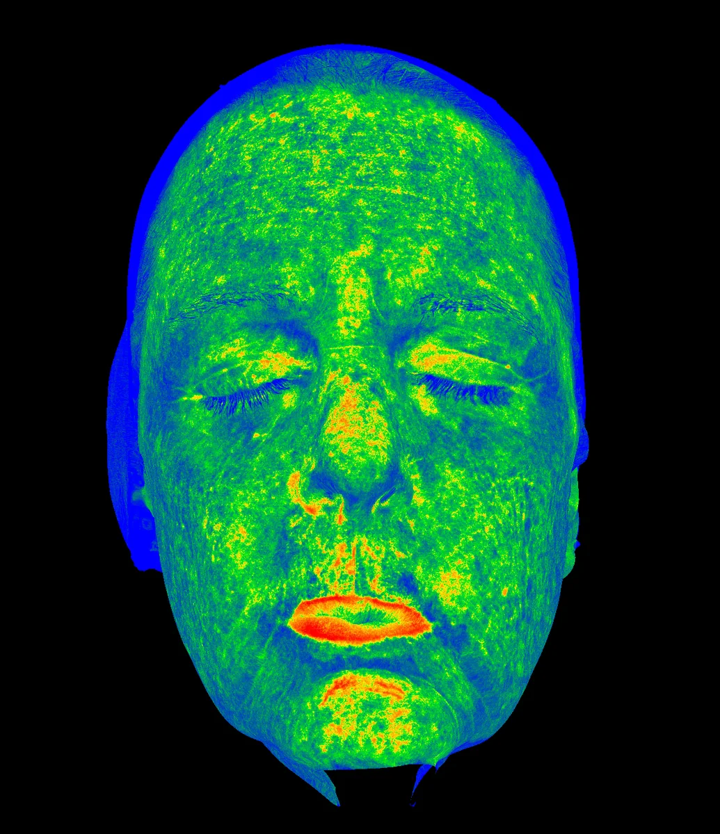 Red Heat Zone diagnostic imaging view