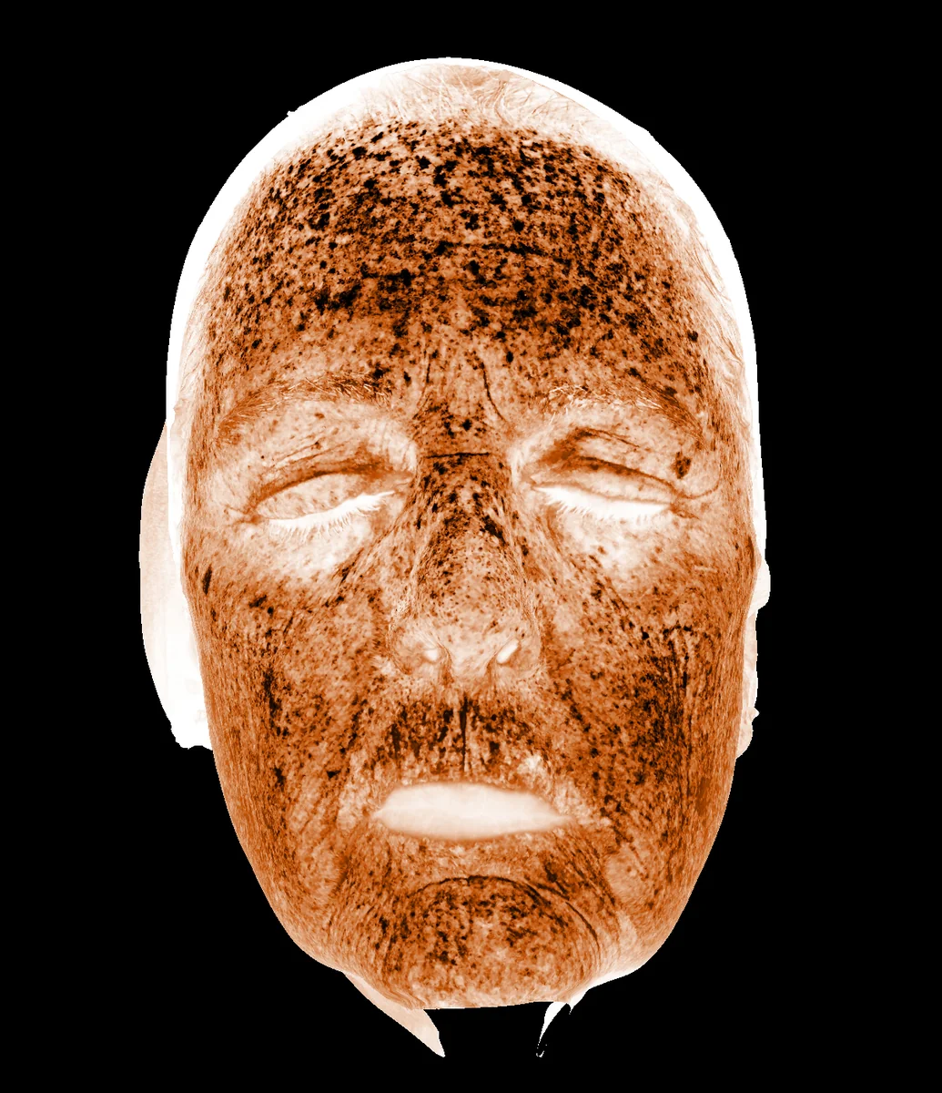 Deep Brown Zone diagnostic imaging view